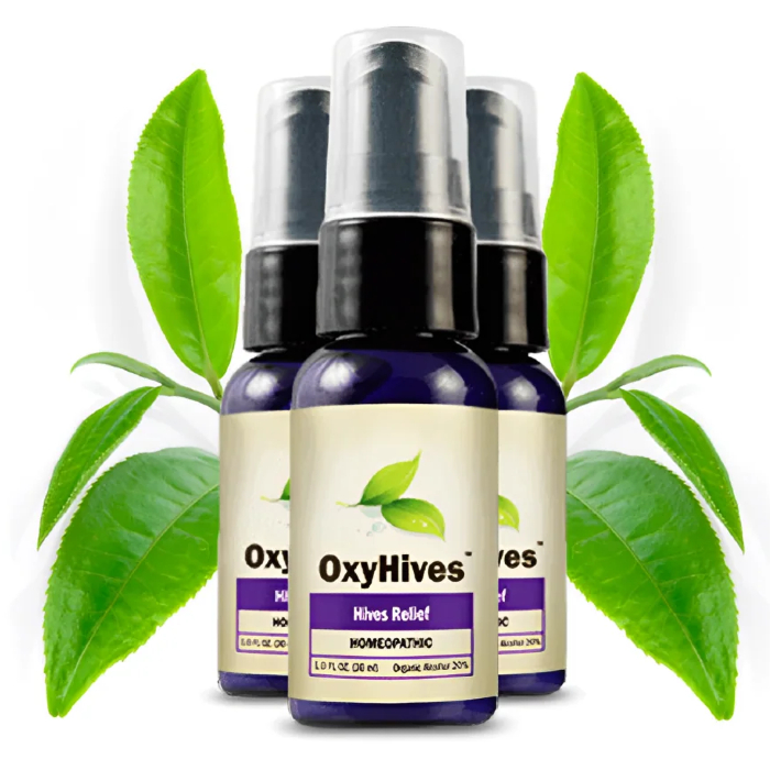 oxyhives hives treatment